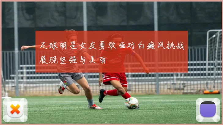 足球明星女友勇敢面对白癜风挑战展现坚强与美丽